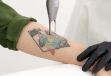 Tattoo Removal Clinic