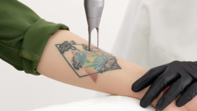 Tattoo Removal Clinic