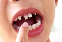 Signs Your Child May Have Early Tooth Decay