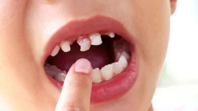 Signs Your Child May Have Early Tooth Decay