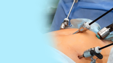 Laparoscopic vs Open Surgery