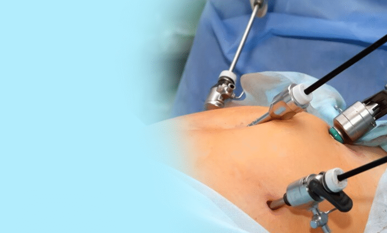 Laparoscopic vs Open Surgery