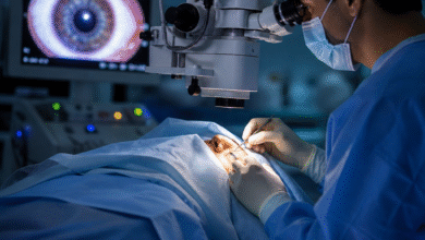 Cataract Surgery